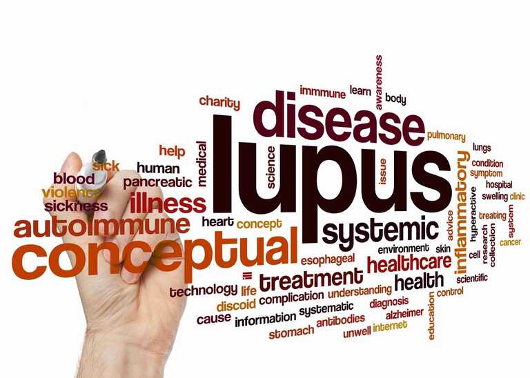 Yourday2day Lupus information
